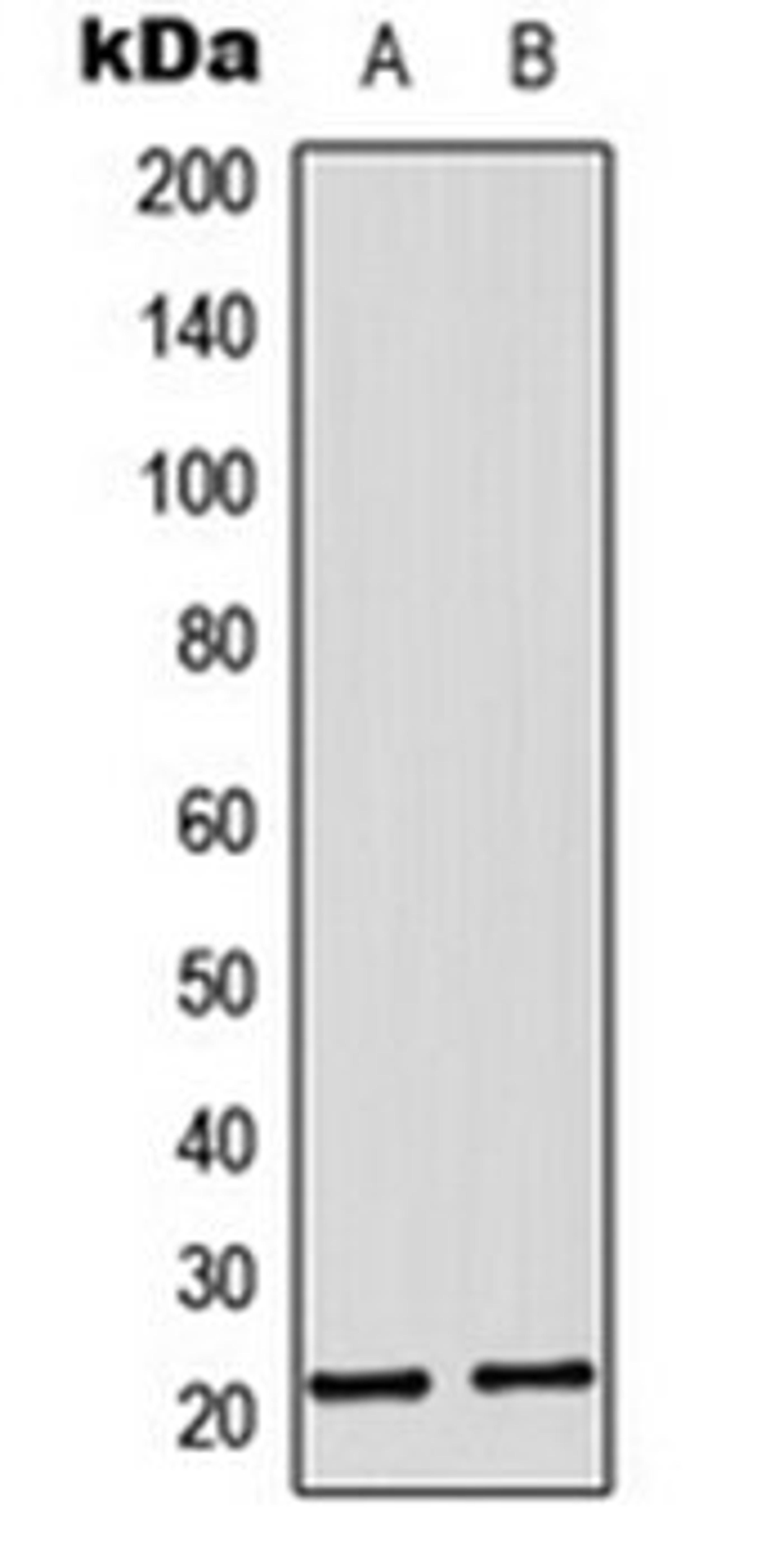 Western blot analysis of A431 (Lane 1), HepG2 (Lane 2) whole cell lysates using MRPL11 antibody