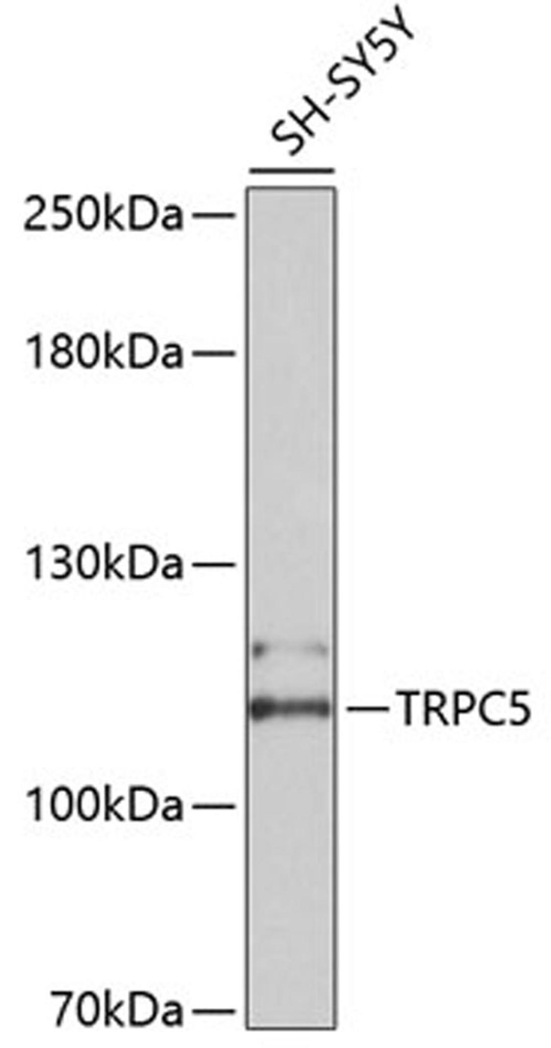 Western blot - TRPC5 antibody (A10089)
