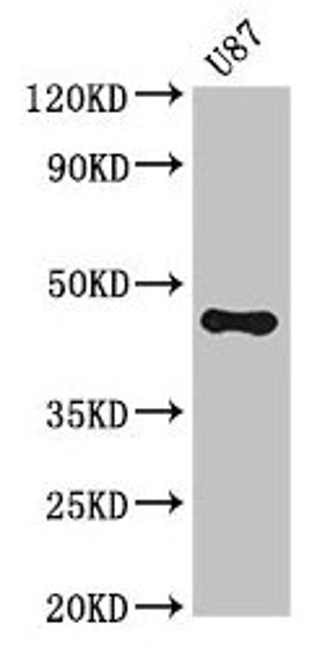 Western Blot. Positive WB detected in: U87 whole cell lysate. All lanes: ST8SIA5 antibody at 3.5µg/ml. Secondary. Goat polyclonal to rabbit IgG at 1/50000 dilution. Predicted band size: 44, 48 kDa. Observed band size: 44 kDa