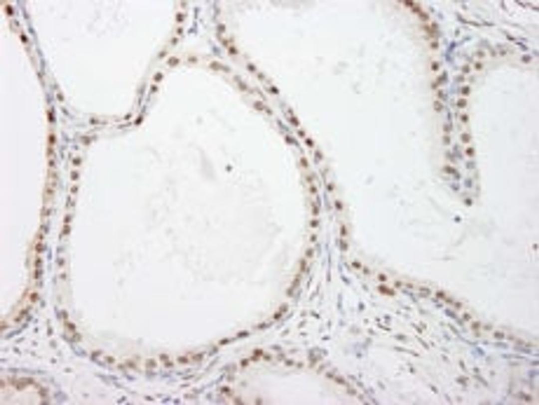 Detection of human FKBP5/FKBP51 by immunohistochemistry.