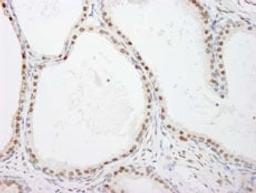 Detection of human FKBP5/FKBP51 by immunohistochemistry.