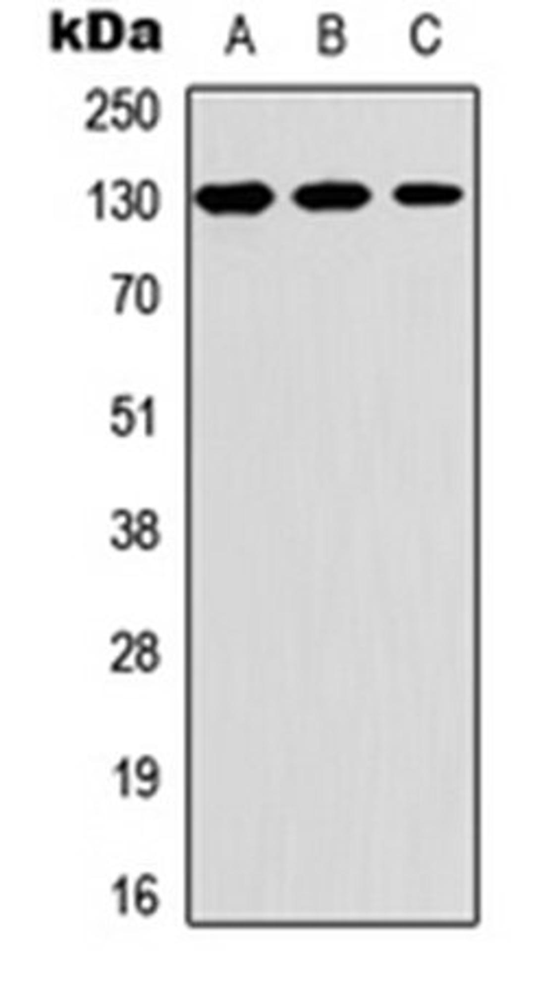 Western blot analysis of A549 (Lane 1), Raw264.7 (Lane 2), PC12 (Lane 3) whole cell lysates using Thrombospondin 2 antibody