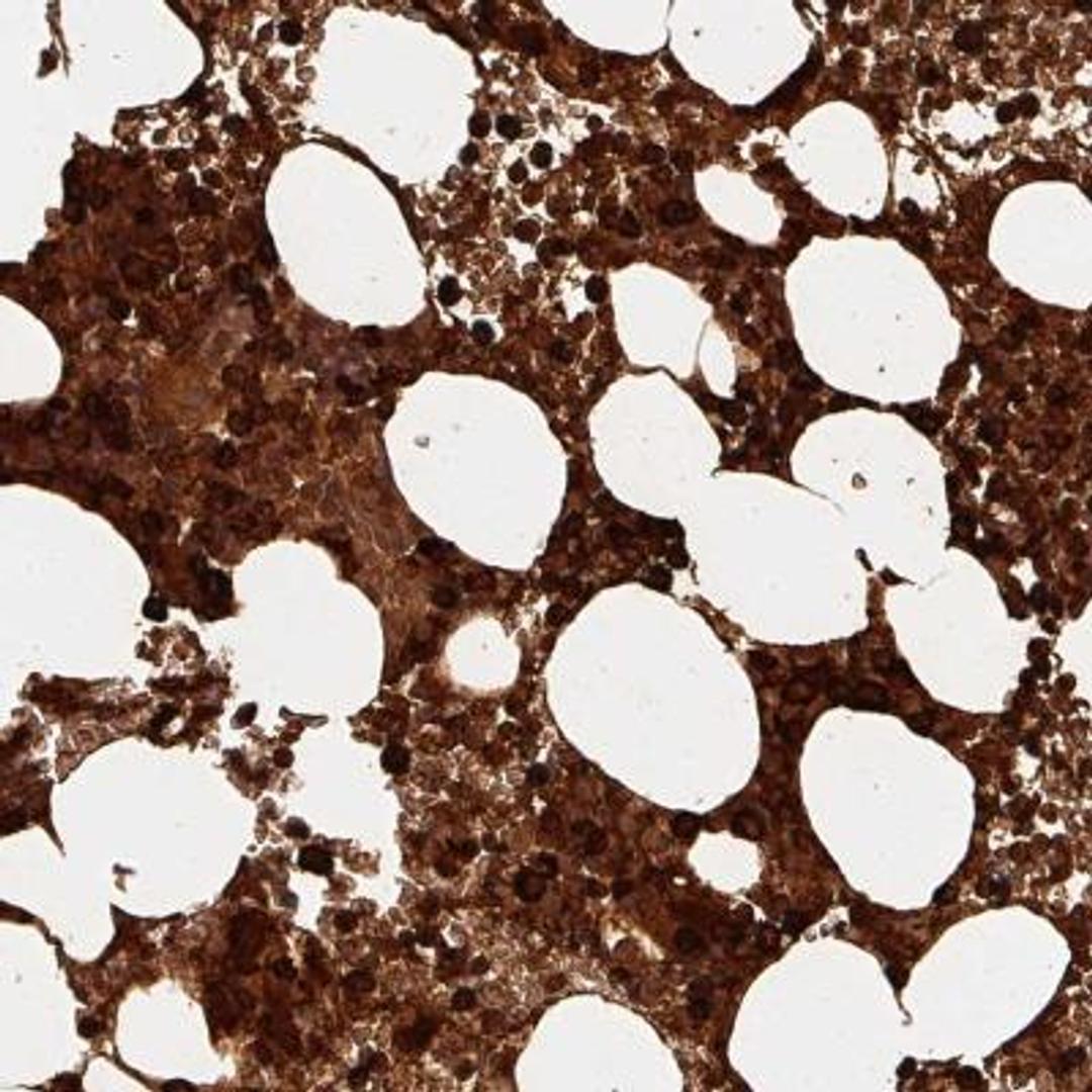 Immunohistochemistry: alpha-Defensin 1 Antibody [NBP2-46808] - Analysis of human bone marrow shows strong cytoplasmic positivity in hematopoietic cells.