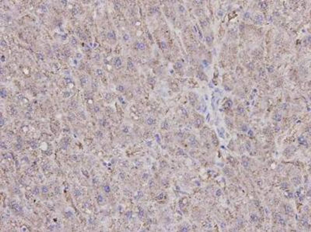 Immunohistochemical analysis of human liver tissue using Caspase 1 antibody