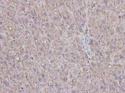 Immunohistochemical analysis of human liver tissue using Caspase 1 antibody