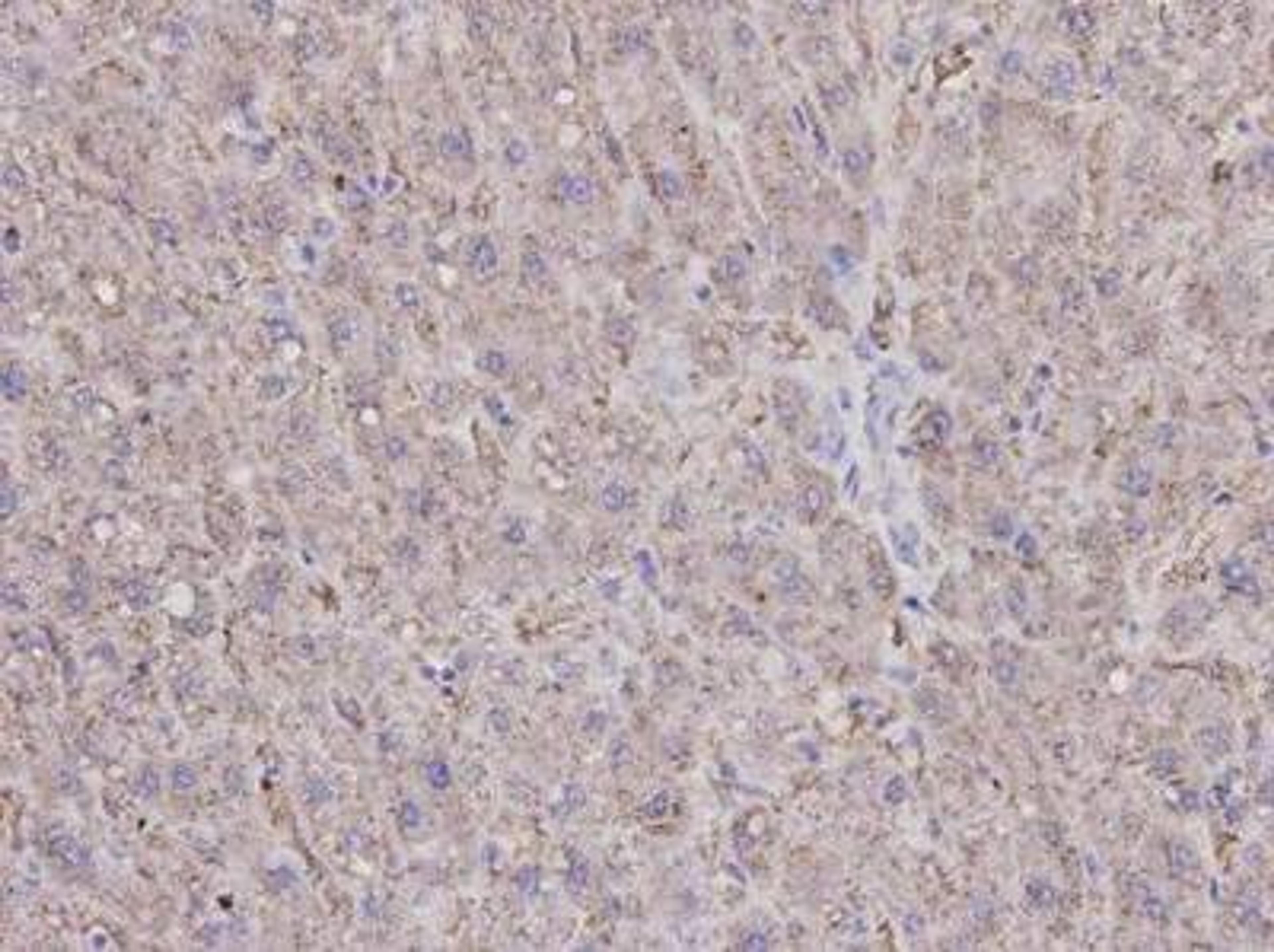 Immunohistochemical analysis of human liver tissue using Caspase 1 antibody