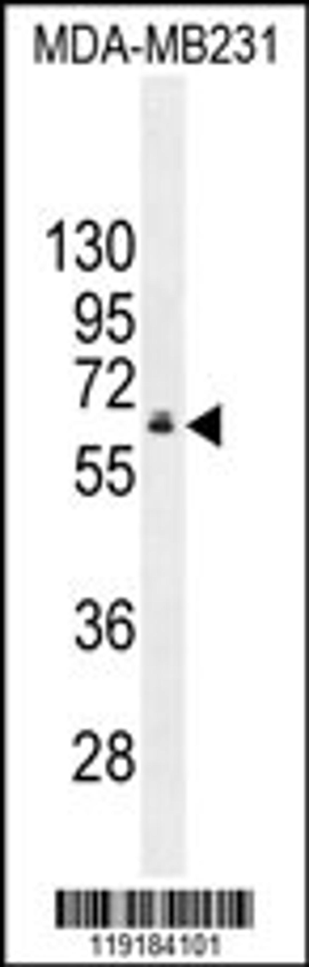 Western blot analysis in MDA-MB231 cell line lysates (35ug/lane).