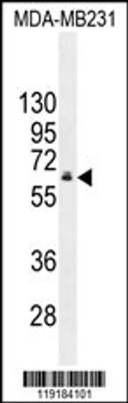 Western blot analysis in MDA-MB231 cell line lysates (35ug/lane).