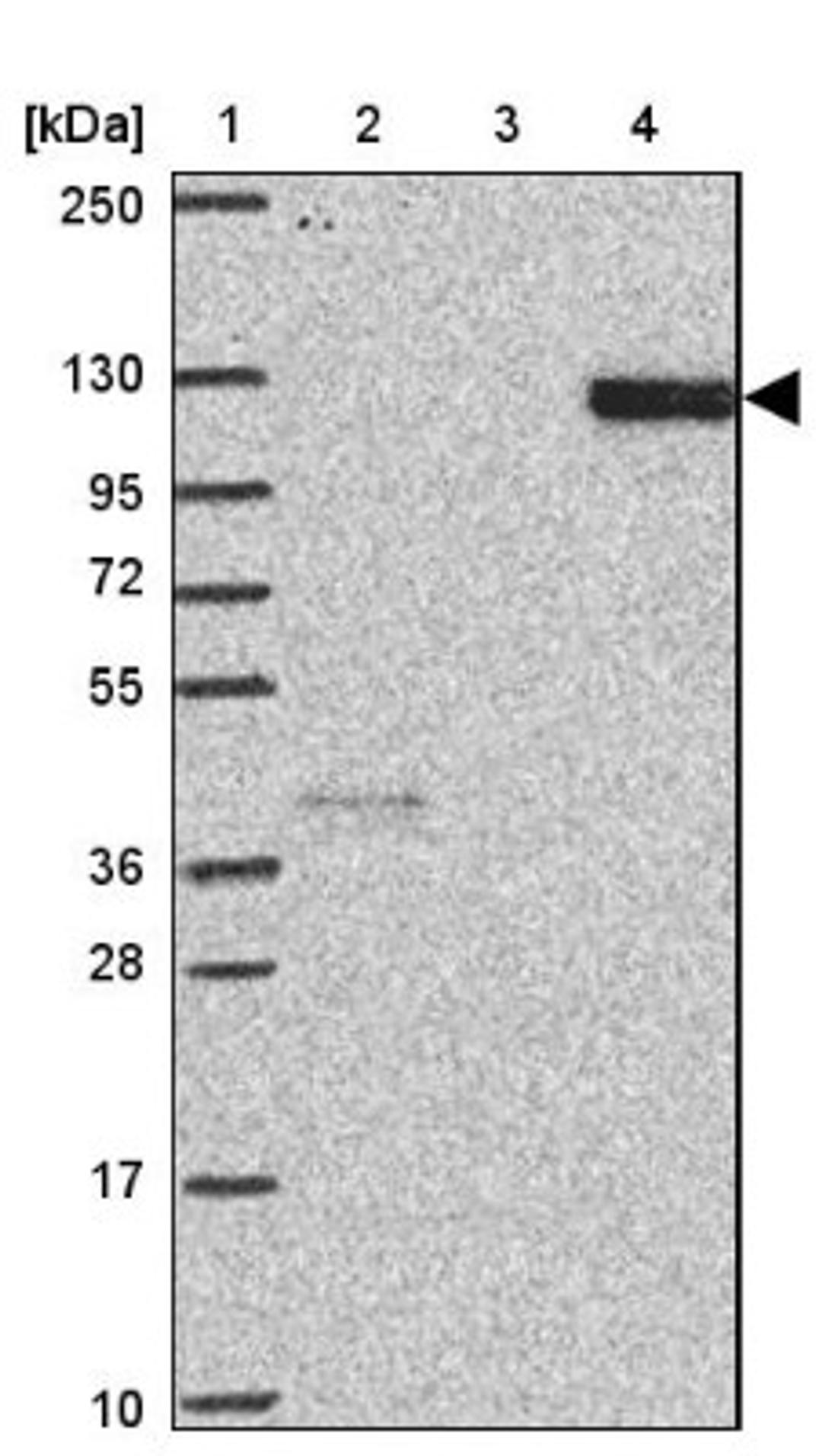 Western Blot: FBXW10 Antibody [NBP2-33651] - Lane 1: Marker [kDa] 250, 130, 95, 72, 55, 36, 28, 17, 10<br/>Lane 2: Human cell line RT-4<br/>Lane 3: Human cell line U-251MG sp<br/>Lane 4: Human plasma (IgG/HSA depleted)