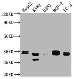 Western Blot. Positive WB detected in: HepG2 whole cell lysate, K562 whole cell lysate, U251 whole cell lysate, MCF-7 whole cell lysate, PC-3 whole cell lysate. All lanes: RPIA antibody at 1:2000. Secondary. Goat polyclonal to rabbit IgG at 1/50000 dilution. Predicted band size: 34 kDa. Observed band size: 33 kDa.