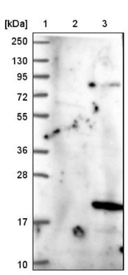 Western Blot: PGL2 Antibody [NBP1-92260] - Lane 1: Marker [kDa] 250, 130, 95, 72, 55, 36, 28, 17, 10<br/>Lane 2: Negative control (vector only transfected HEK293T lysate)<br/>Lane 3: Over-expression lysate (Co-expressed with a C-terminal myc-DDK tag (~3.1 kDa) in mammalian HEK293T cells, LY402625)