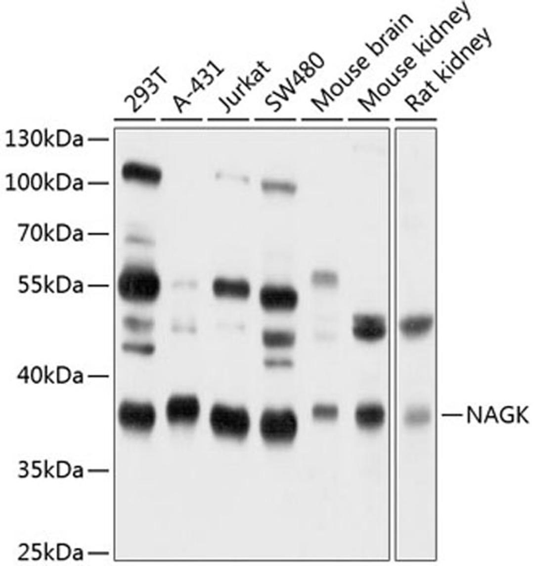 Western blot - NAGK antibody (A9070)