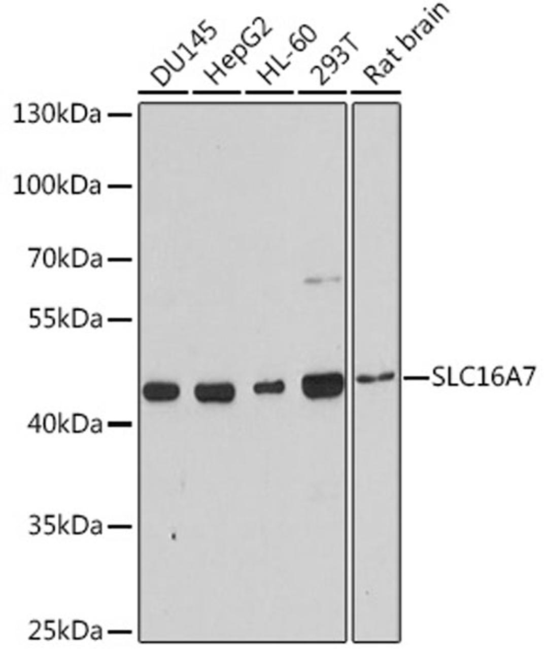Western blot - SLC16A7 antibody (A3015)