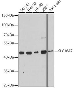 Western blot - SLC16A7 antibody (A3015)