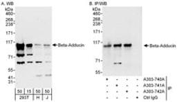 Detection of human Beta-Adducin by western blot and immunoprecipitation.