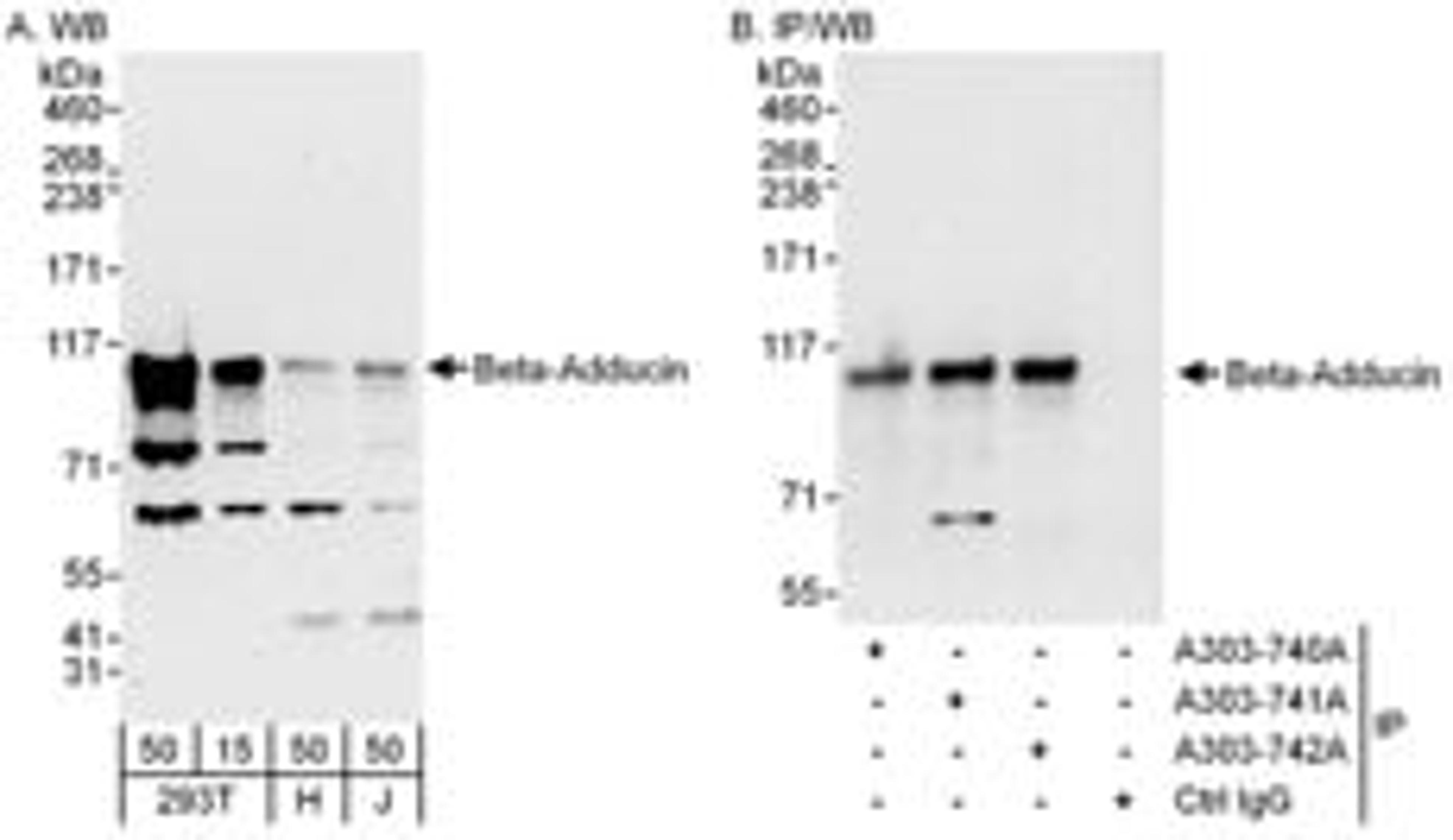 Detection of human Beta-Adducin by western blot and immunoprecipitation.