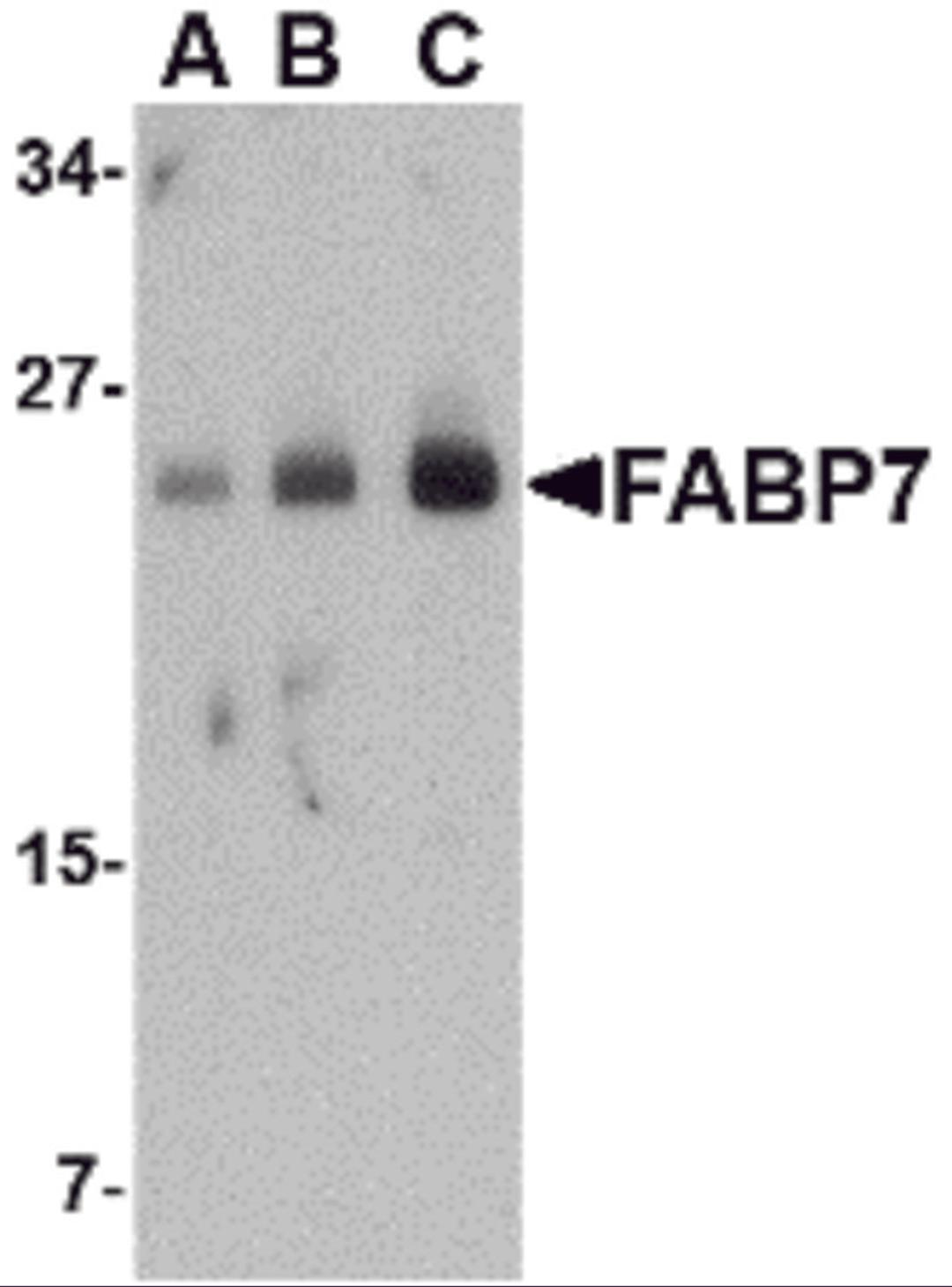 Western blot analysis of FABP7 in human breast tissue lysate with FABP7 antibody at (A) 0.5, (B) 1 and (C) 2 μg/mL.