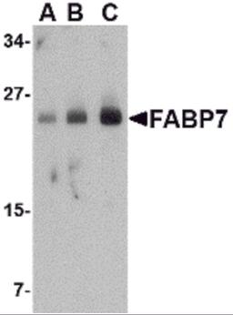 Western blot analysis of FABP7 in human breast tissue lysate with FABP7 antibody at (A) 0.5, (B) 1 and (C) 2 μg/mL.