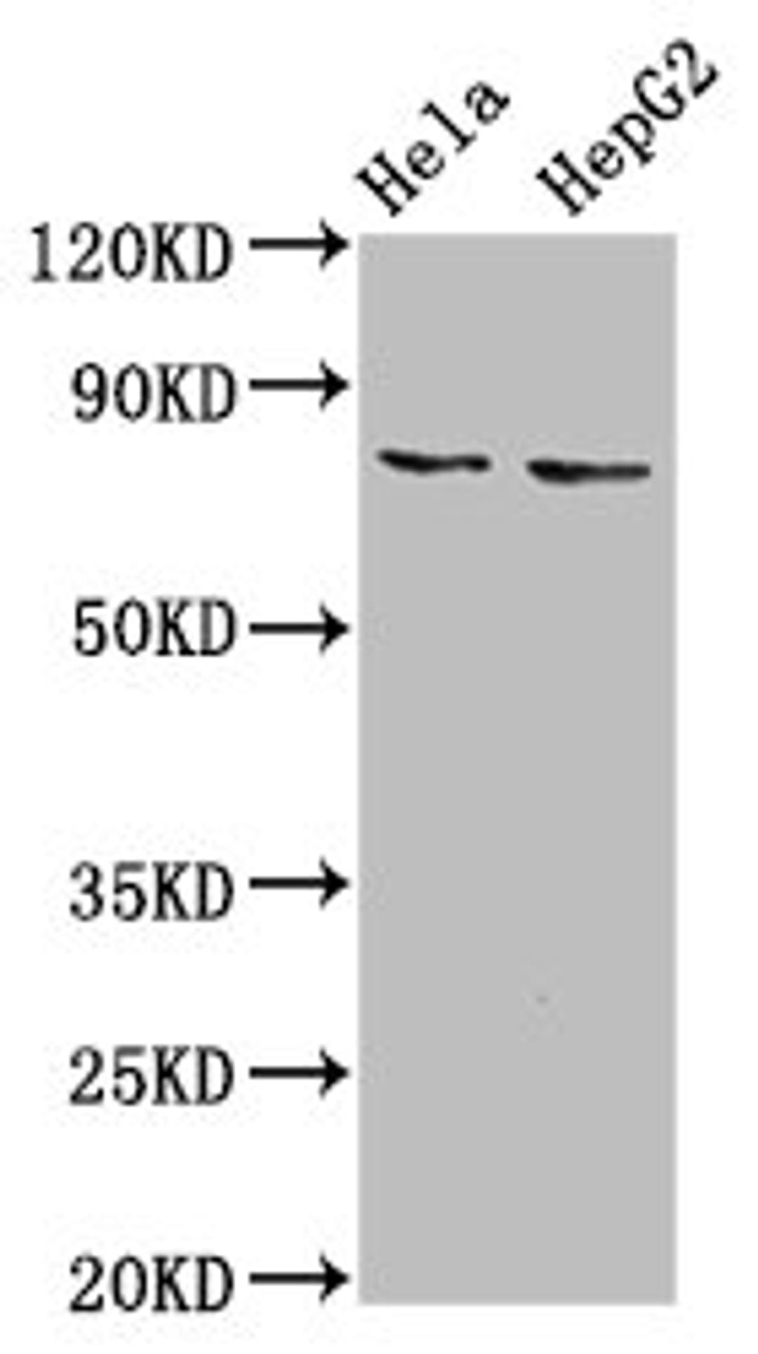 Western Blot. Positive WB detected in: Hela whole cell lysate, HepG2 whole cell lysate. All lanes: ESRP2 antibody at 6µg/ml. Secondary. Goat polyclonal to rabbit IgG at 1/50000 dilution. Predicted band size: 79, 78 kDa. Observed band size: 79 kDa