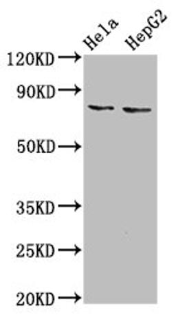 Western Blot. Positive WB detected in: Hela whole cell lysate, HepG2 whole cell lysate. All lanes: ESRP2 antibody at 6µg/ml. Secondary. Goat polyclonal to rabbit IgG at 1/50000 dilution. Predicted band size: 79, 78 kDa. Observed band size: 79 kDa