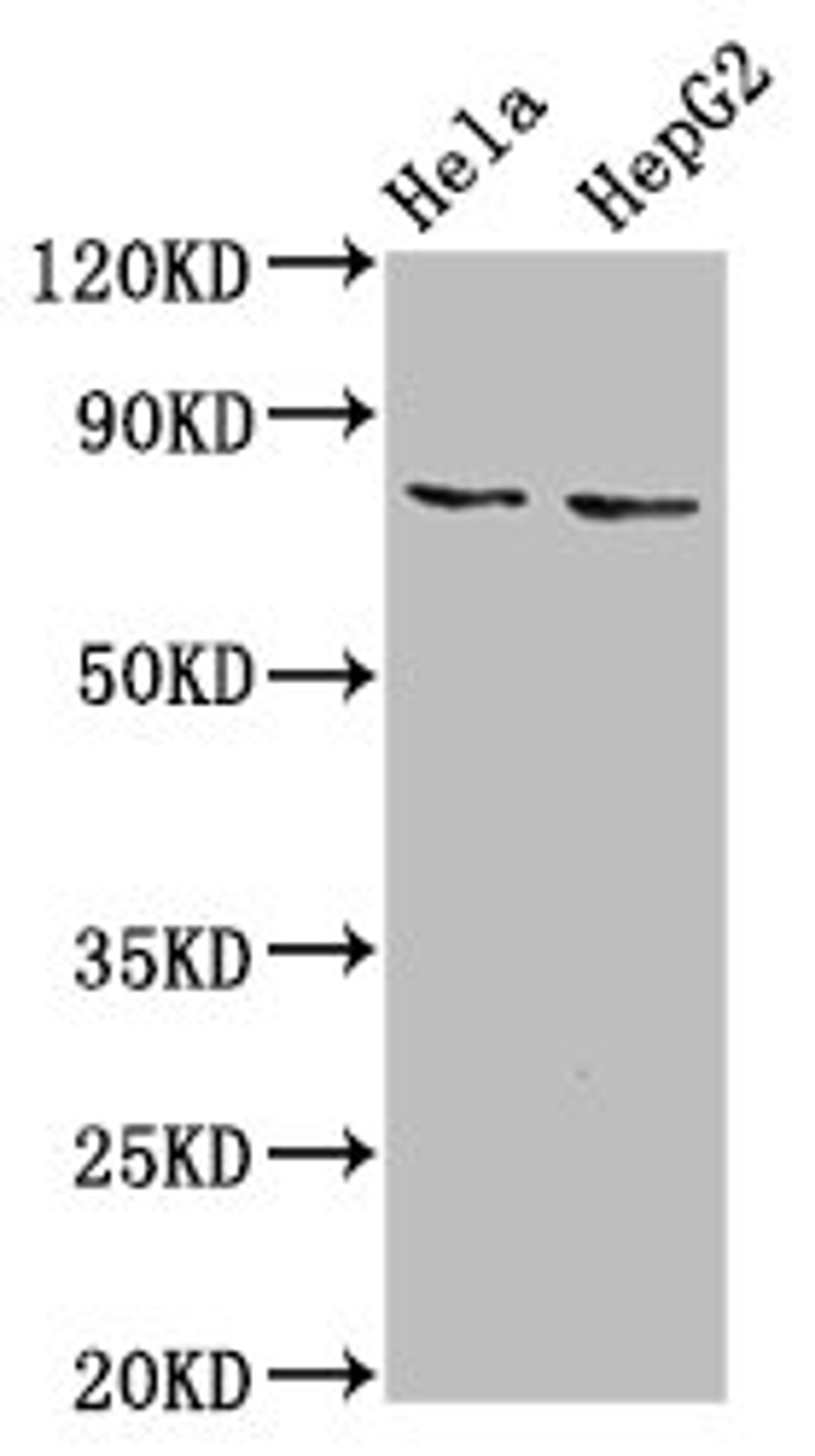 Western Blot. Positive WB detected in: Hela whole cell lysate, HepG2 whole cell lysate. All lanes: ESRP2 antibody at 6µg/ml. Secondary. Goat polyclonal to rabbit IgG at 1/50000 dilution. Predicted band size: 79, 78 kDa. Observed band size: 79 kDa