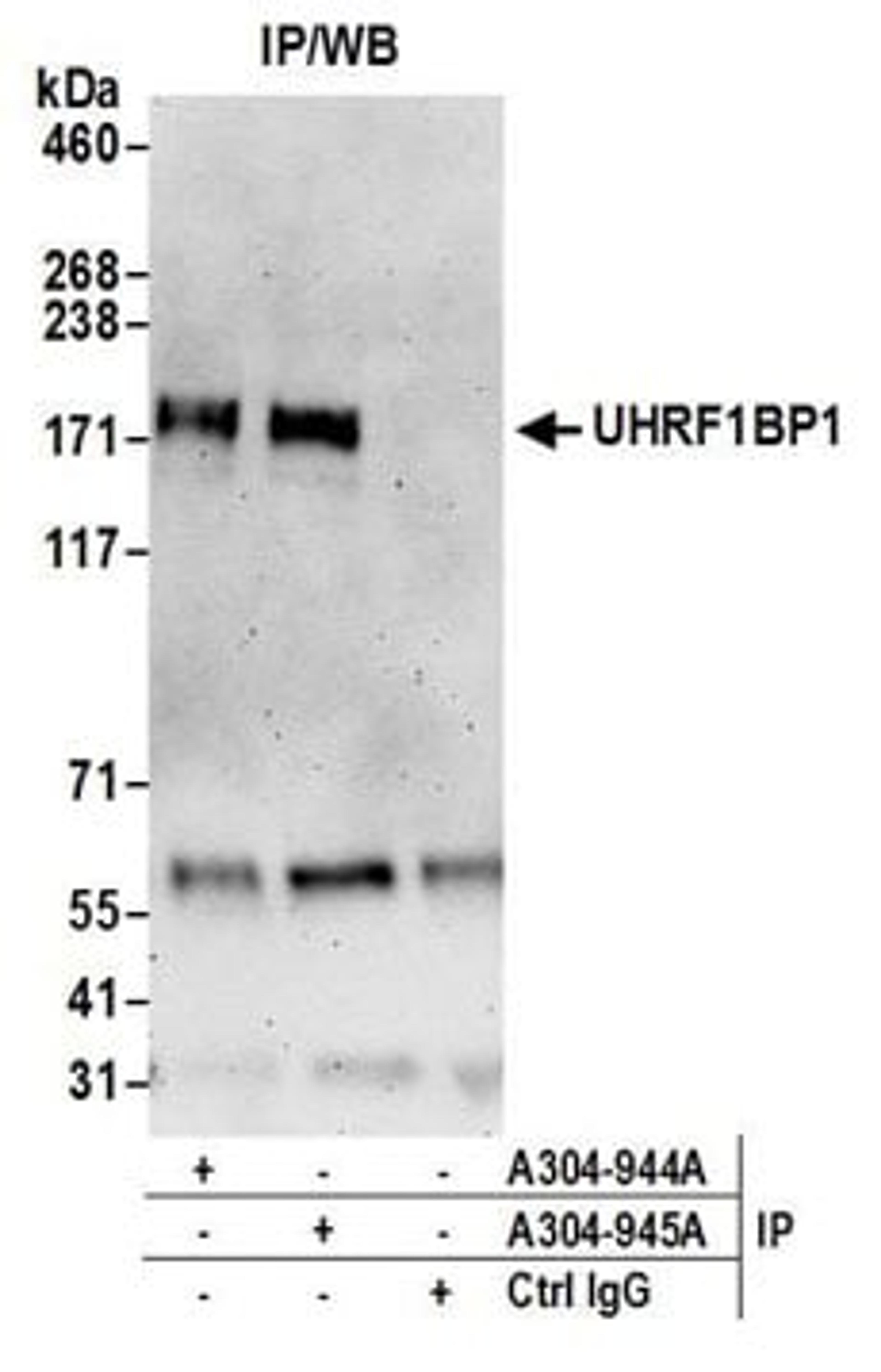 Detection of human UHRF1BP1 by western blot of immunoprecipitates.