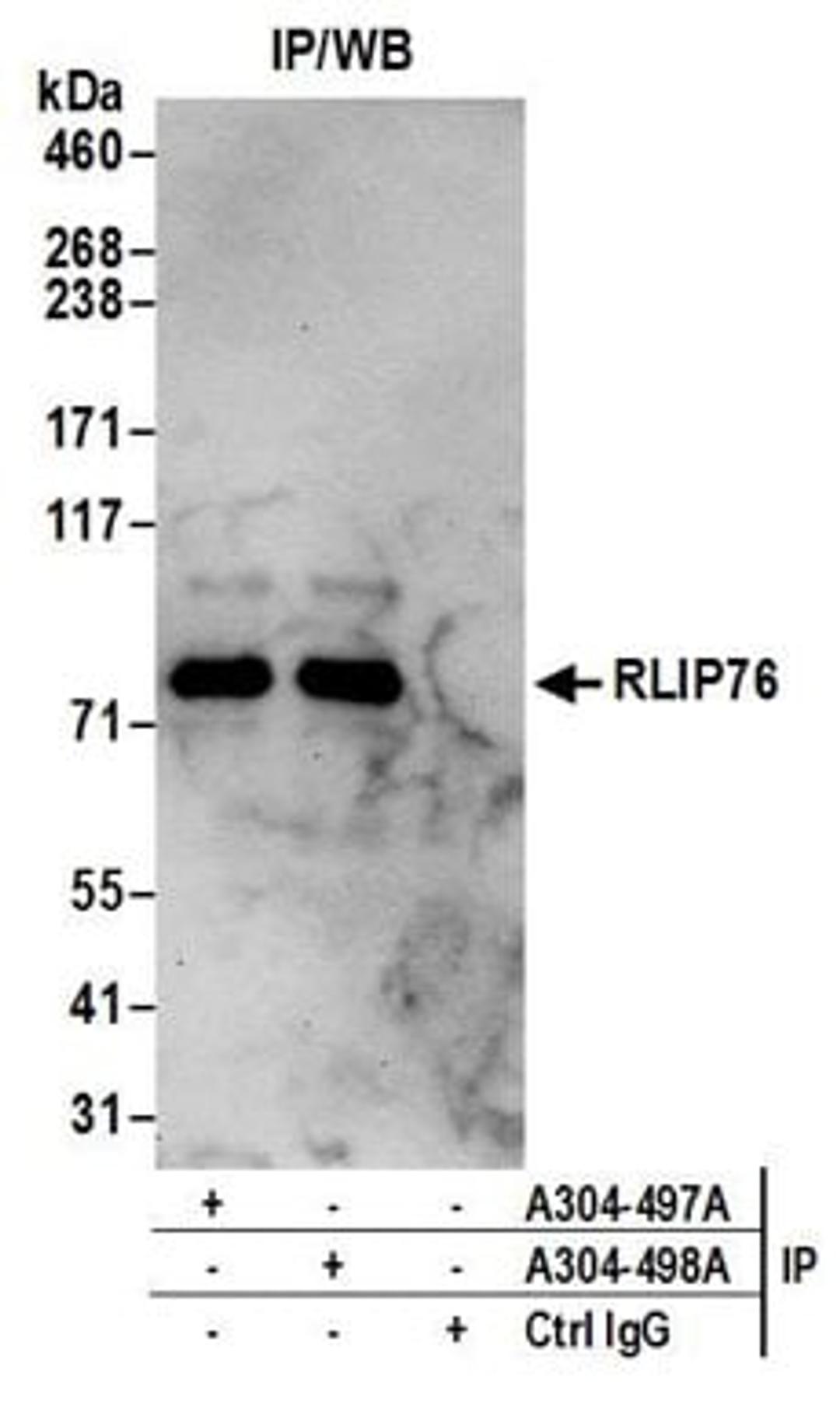 Detection of human RLIP76 by western blot of immunoprecipitates.