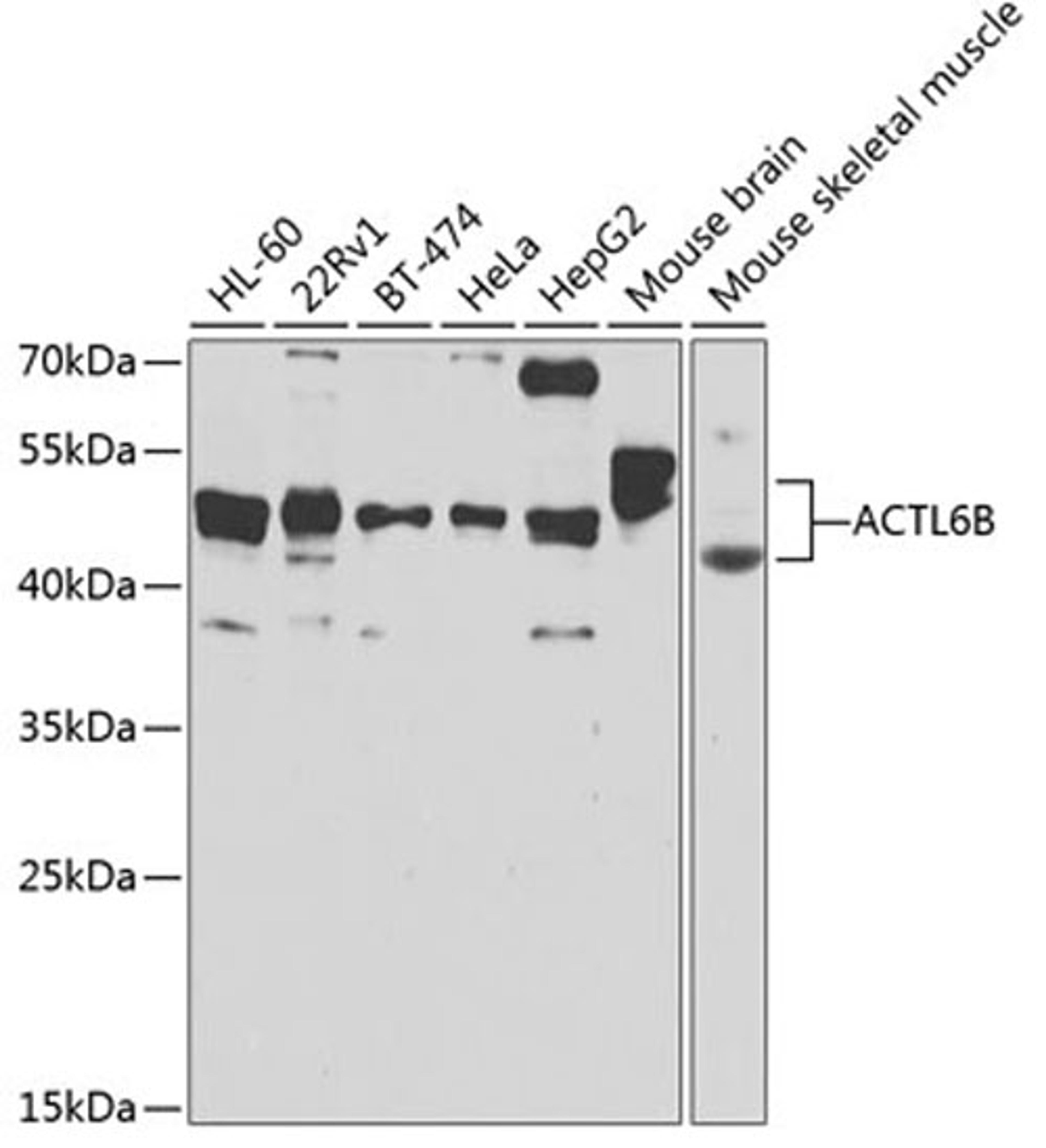 Western blot - ACTL6B antibody (A7108)