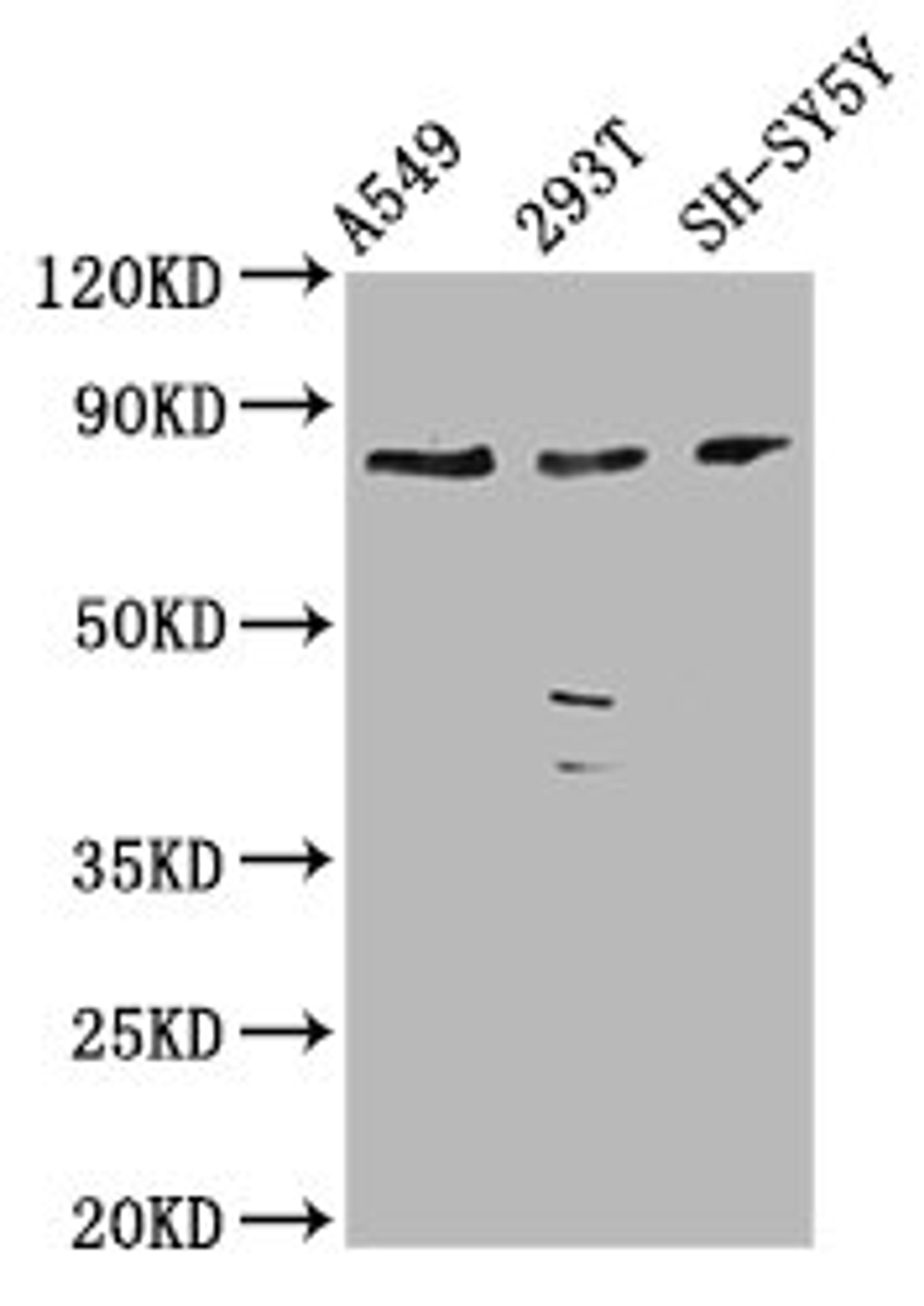 Western Blot. Positive WB detected in: A549 whole cell lysate, 293T whole cell lysate, SH-SY5Y whole cell lysate. All lanes: ZC3H14 antibody at 3.9µg/ml. Secondary. Goat polyclonal to rabbit IgG at 1/50000 dilution. Predicted band size: 83, 66, 65, 81, 35, 33, 62, 67 kDa. Observed band size: 83 kDa