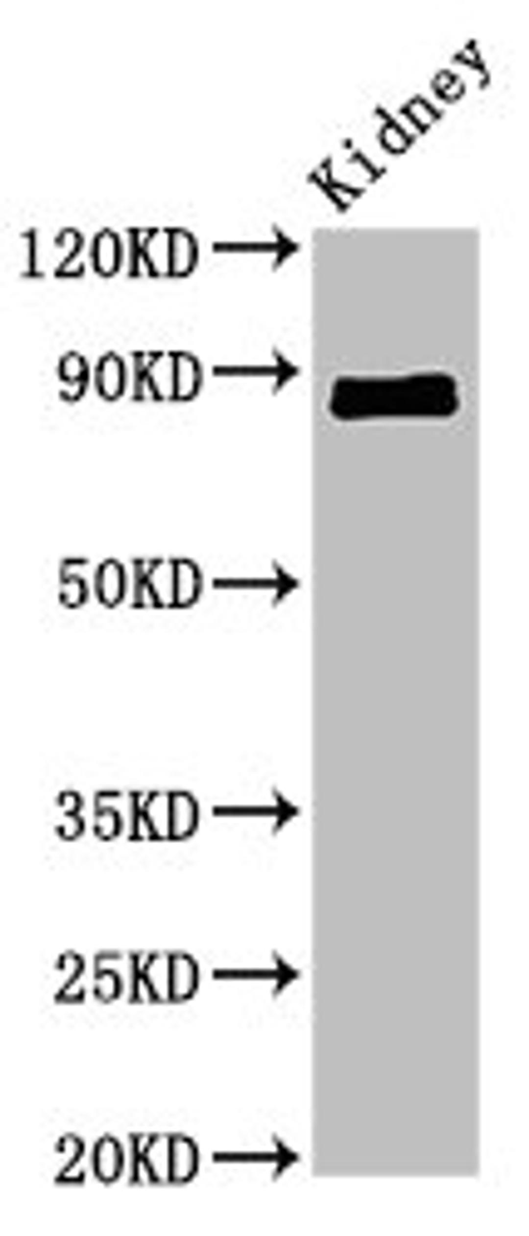 Western Blot. Positive WB detected in: Mouse kidney tissue. All lanes: CDH18 antibody at 2.4ug/ml. Secondary. Goat polyclonal to rabbit IgG at 1/50000 dilution. Predicted band size: 89, 64 kDa. Observed band size: 89 kDa.
