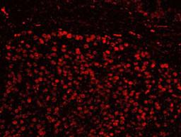 Detection of human SFRS14 by IHC-IF.