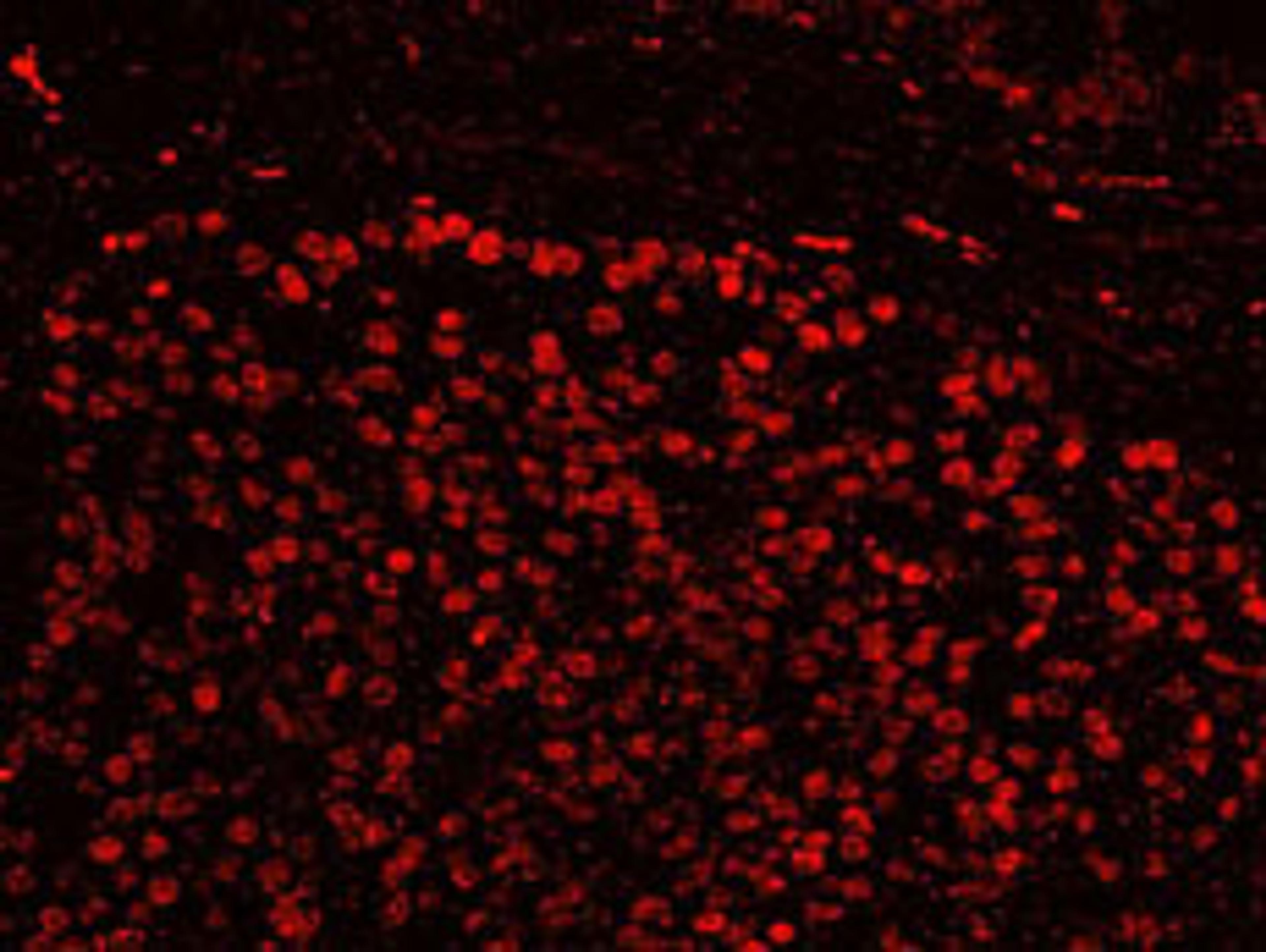 Detection of human SFRS14 by IHC-IF.