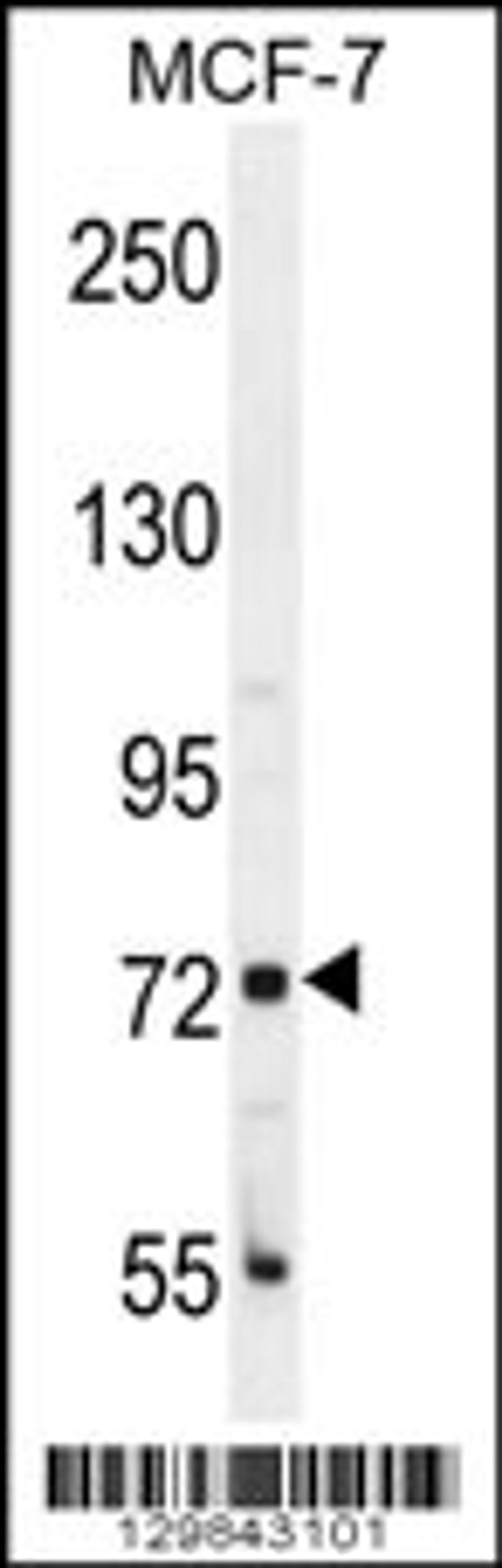 Western blot analysis in MCF-7 cell line lysates (35ug/lane).