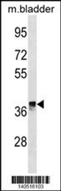 Western blot analysis in mouse bladder tissue lysates (35ug/lane).