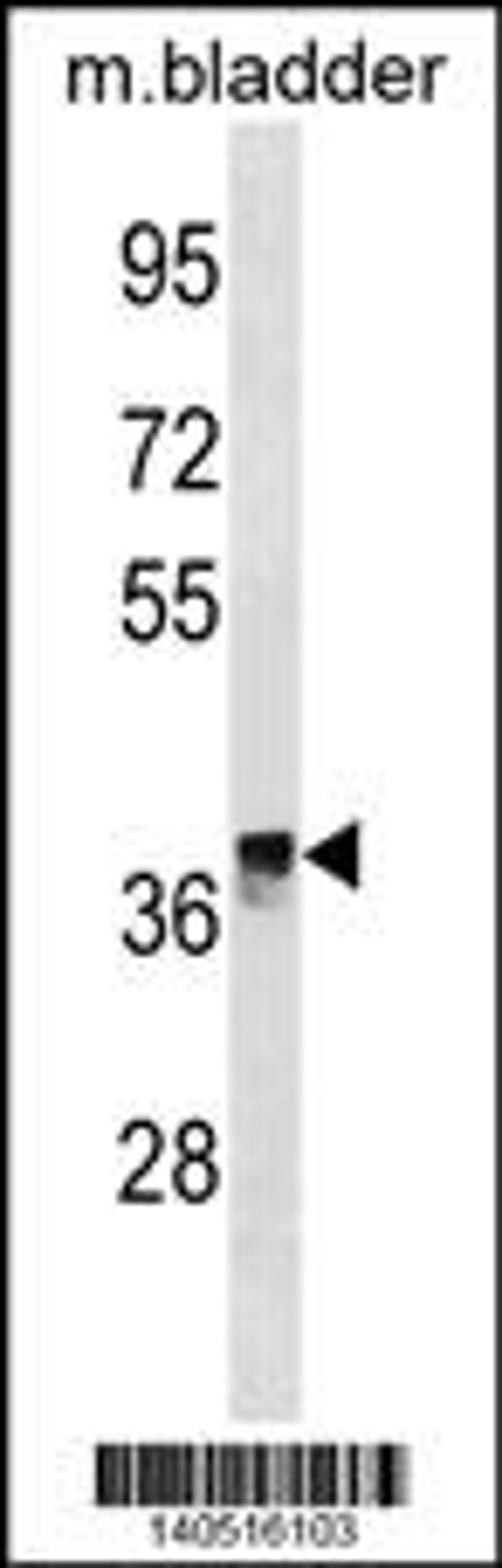 Western blot analysis in mouse bladder tissue lysates (35ug/lane).