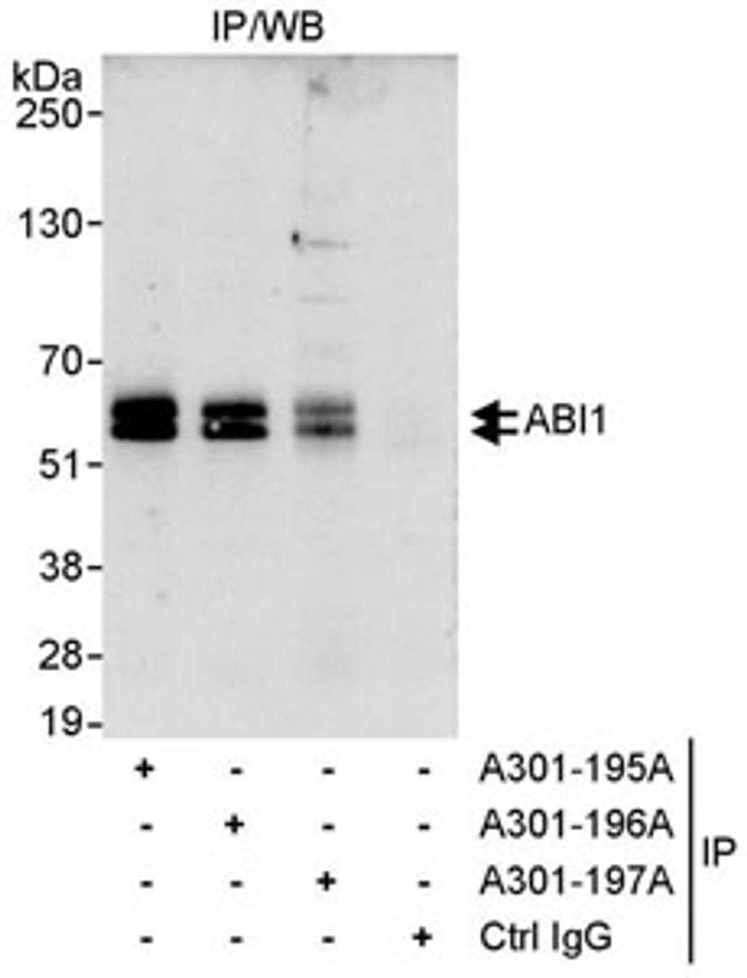 Detection of human ABI1 by western blot of immunoprecipitates.