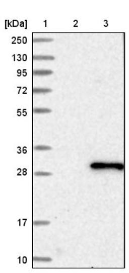 Western Blot: RAB14 Antibody [NBP1-84720] - Lane 1: Marker [kDa] 250, 130, 95, 72, 55, 36, 28, 17, 10<br/>Lane 2: Negative control (vector only transfected HEK293T lysate)<br/>Lane 3: Over-expression lysate (Co-expressed with a C-terminal myc-DDK tag (~3.1 kDa) in mammalian HEK293T cells, LY414055)