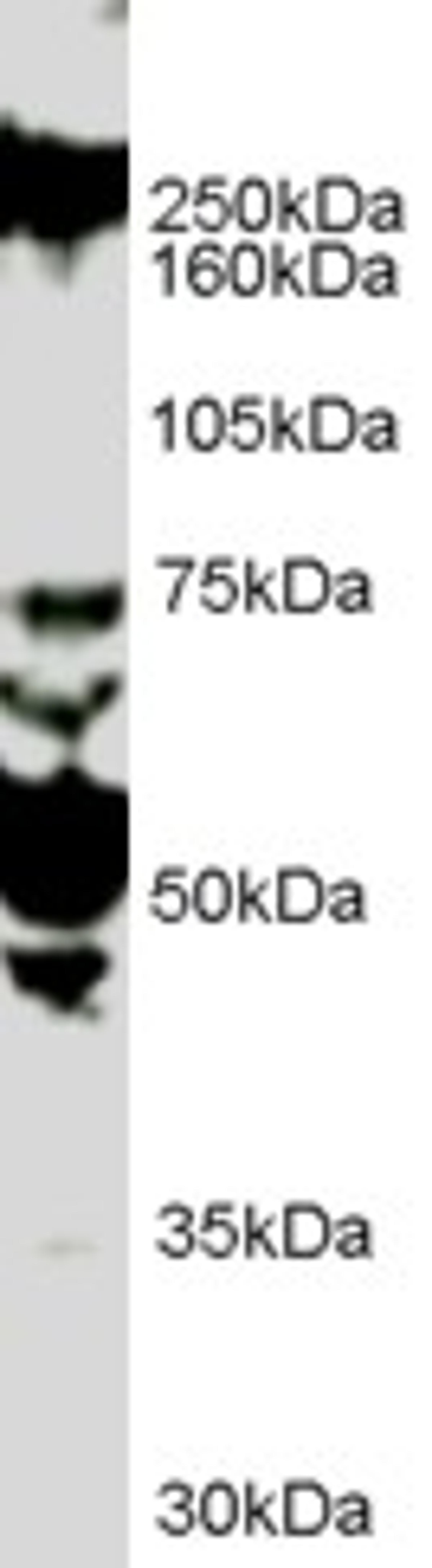 46-315 (1ug/ml) staining of HUVEC lysate (35ug protein in RIPA buffer). Primary incubation was 1 hour. Detected by chemiluminescence.