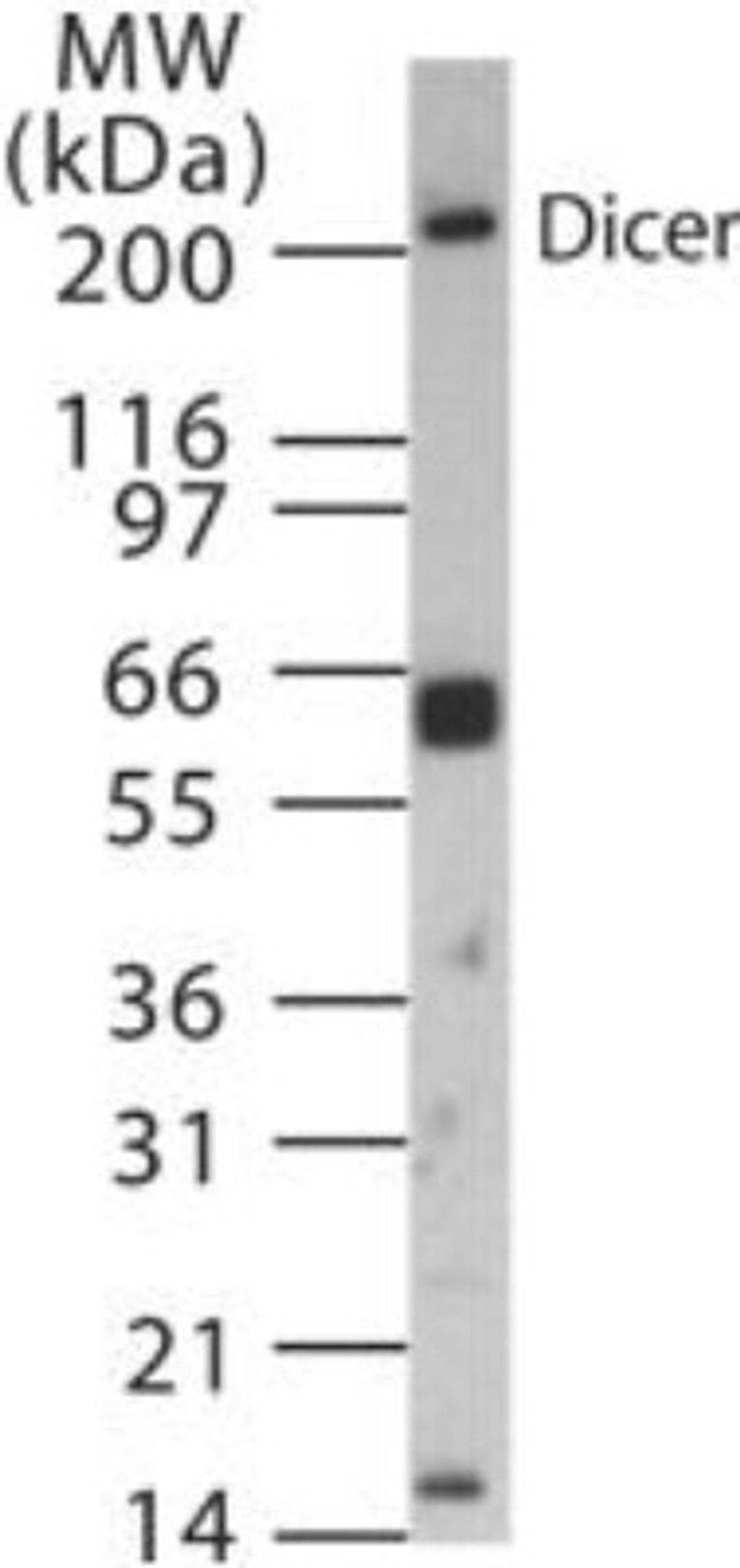 Western Blot: Dicer Antibody [NB200-591] - Mouse ovary tissue lysate probed with Dicer antibody at 1:1000 dilution.