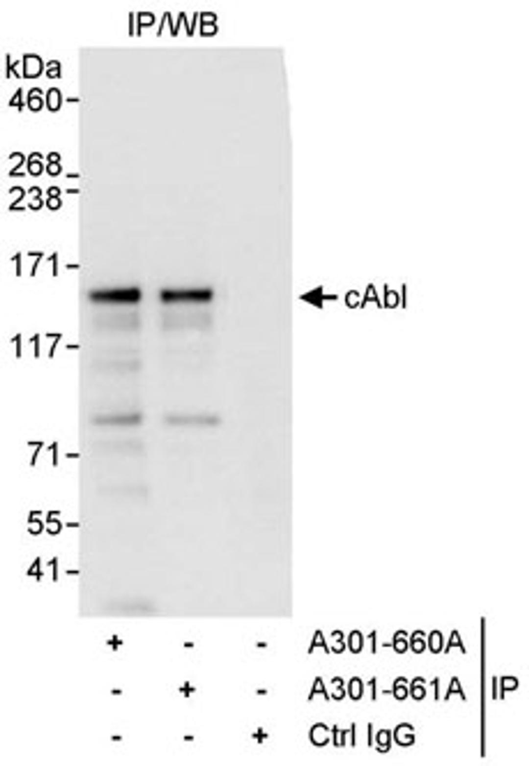 Detection of human cAbl by western blot of immunoprecipitates.