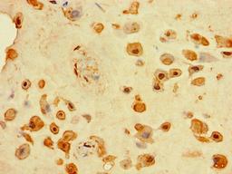 Immunohistochemistry of paraffin-embedded human placenta tissue using CSB-PA875630LA01HU at dilution of 1:100