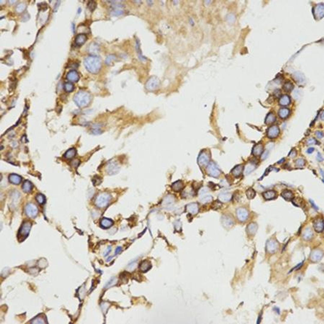 Immunohistochemical analysis of formalin-fixed and paraffin-embedded rat testis tissue using LRPAP1 antibody (primary antibody dilution at 1:200)