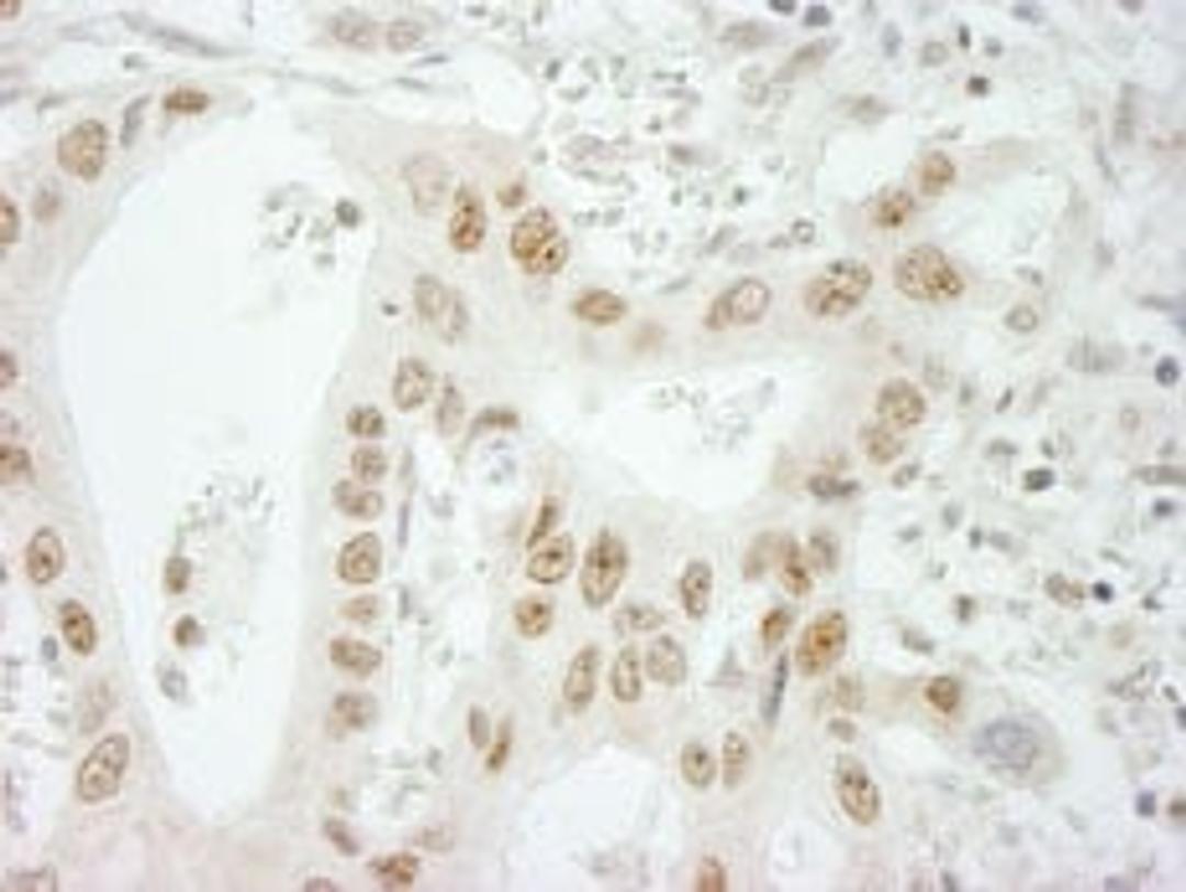 Detection of human SKIV2L2 by immunohistochemistry.