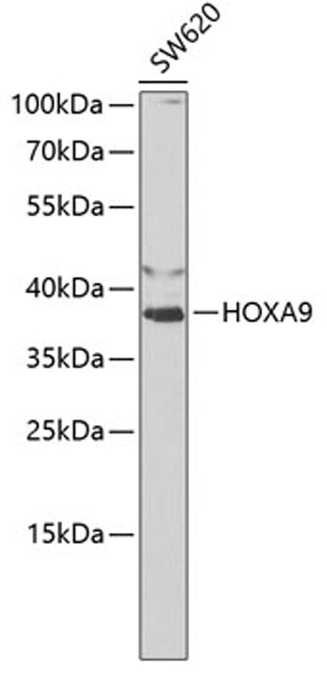 Western blot - HOXA9 antibody (A1908)