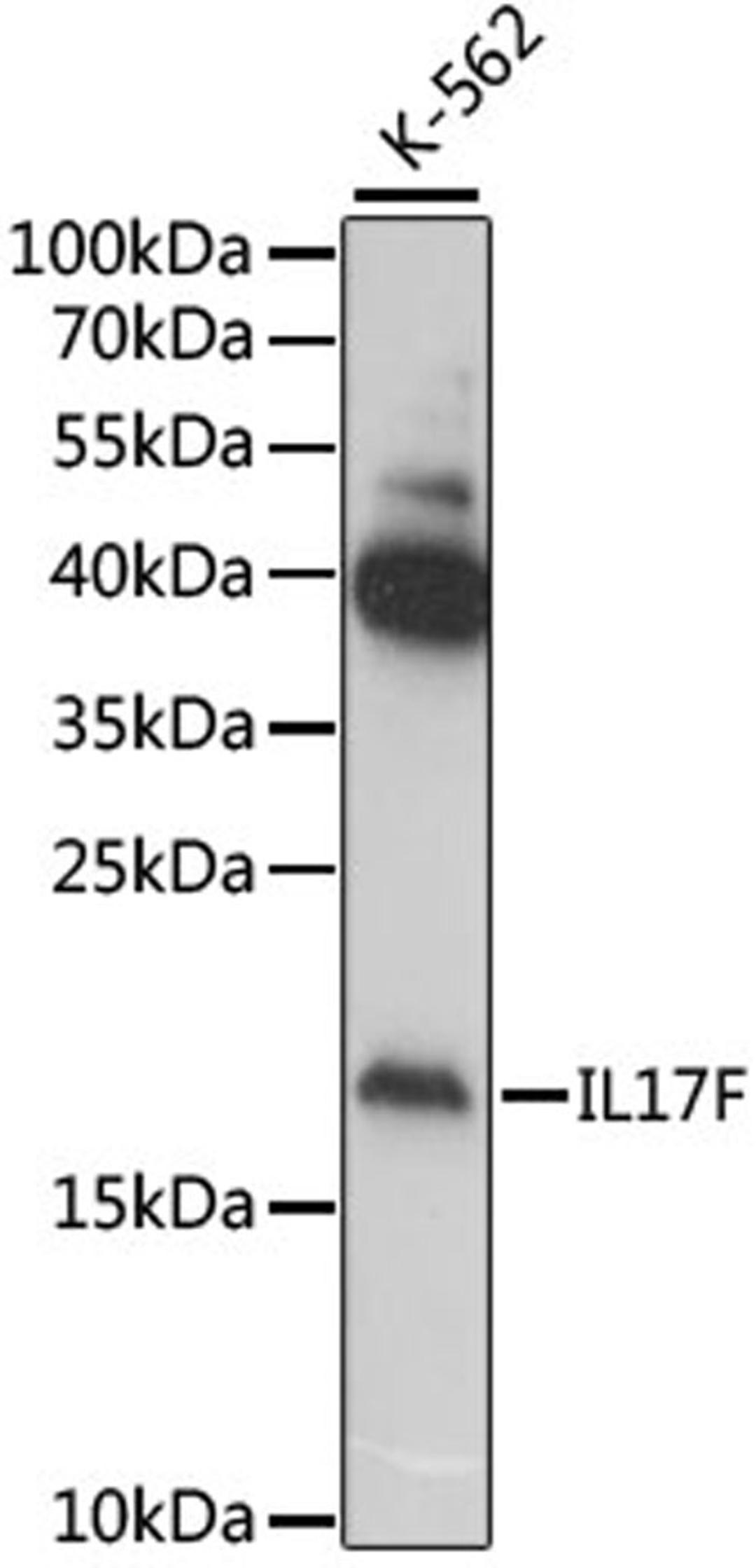 Western blot - IL17F antibody (A6487)