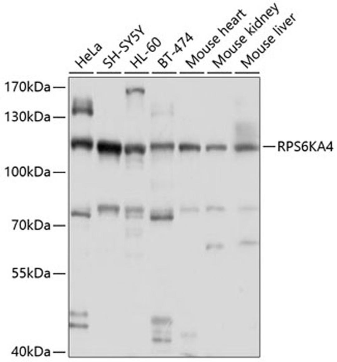 Western blot - RPS6KA4 antibody (A10130)