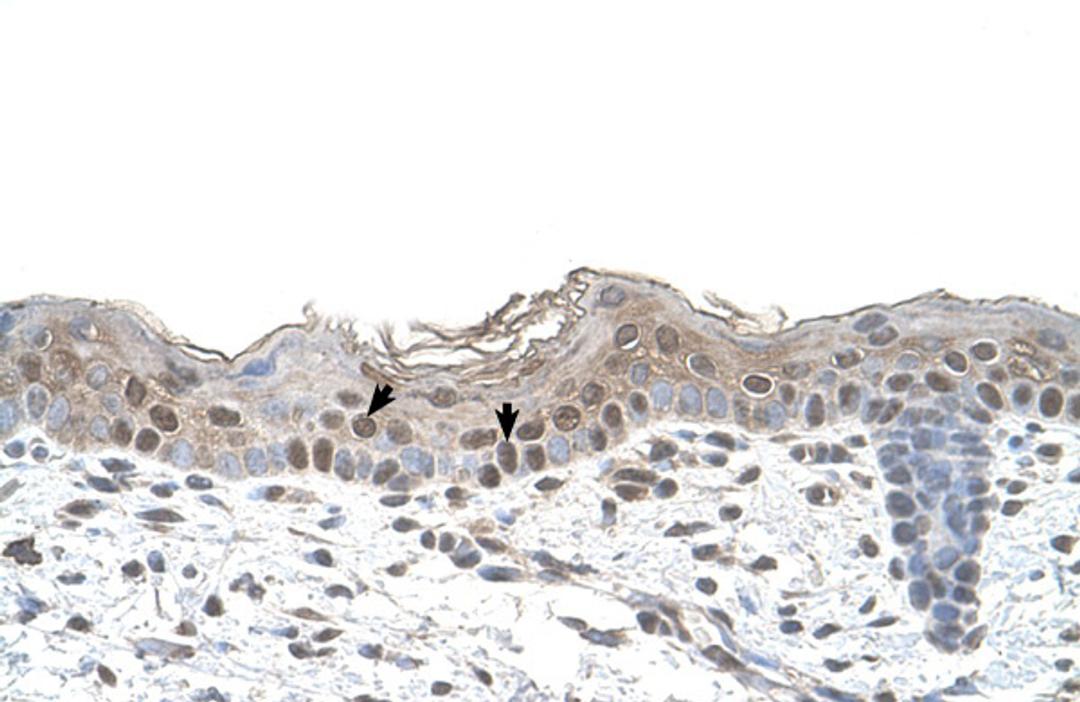 Antibody used in IHC on Human Skin.