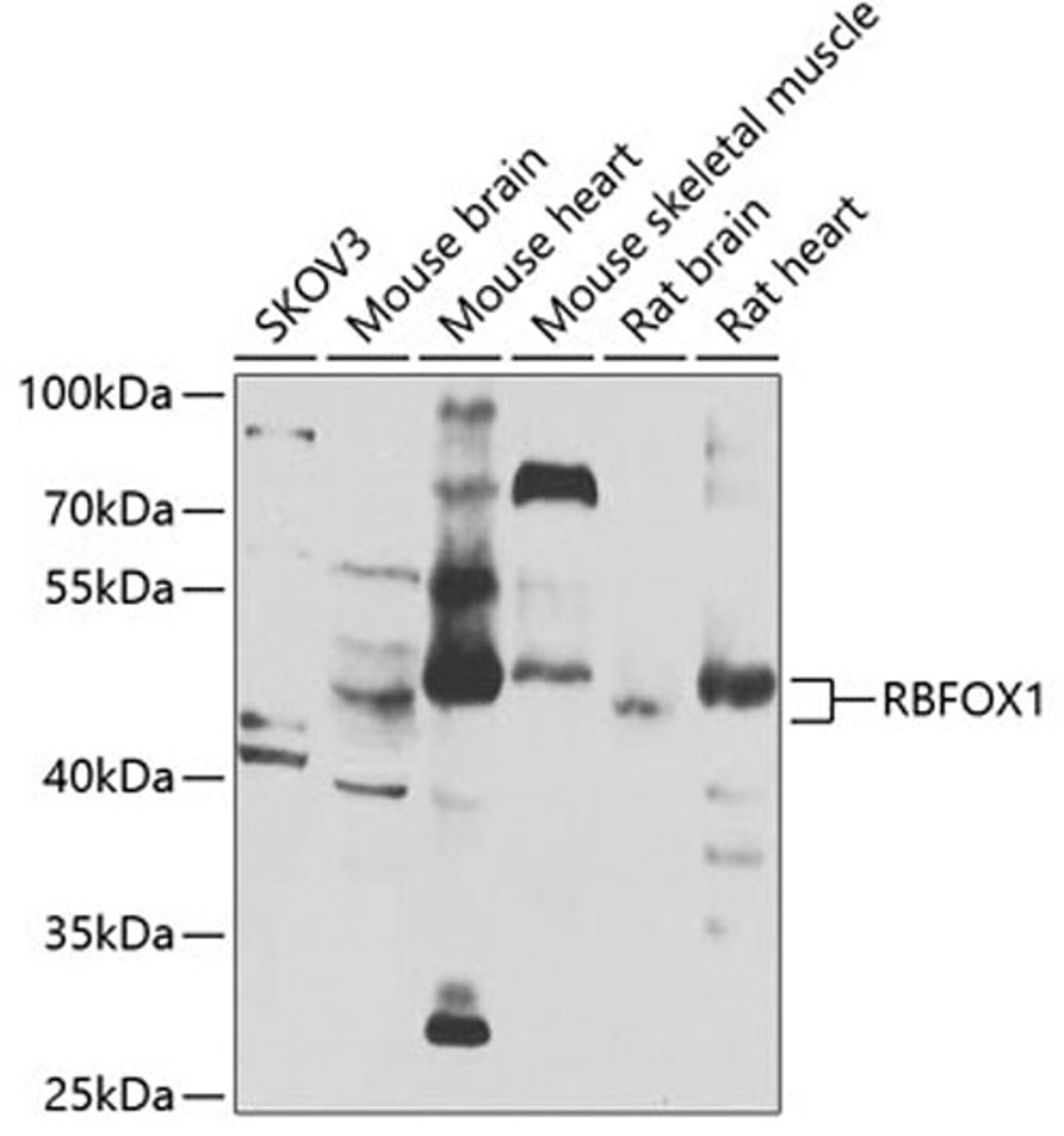 Western blot - RBFOX1 antibody (A7811)