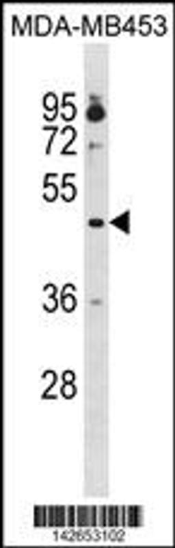 Western blot analysis in MDA-MB453 cell line lysates (35ug/lane).