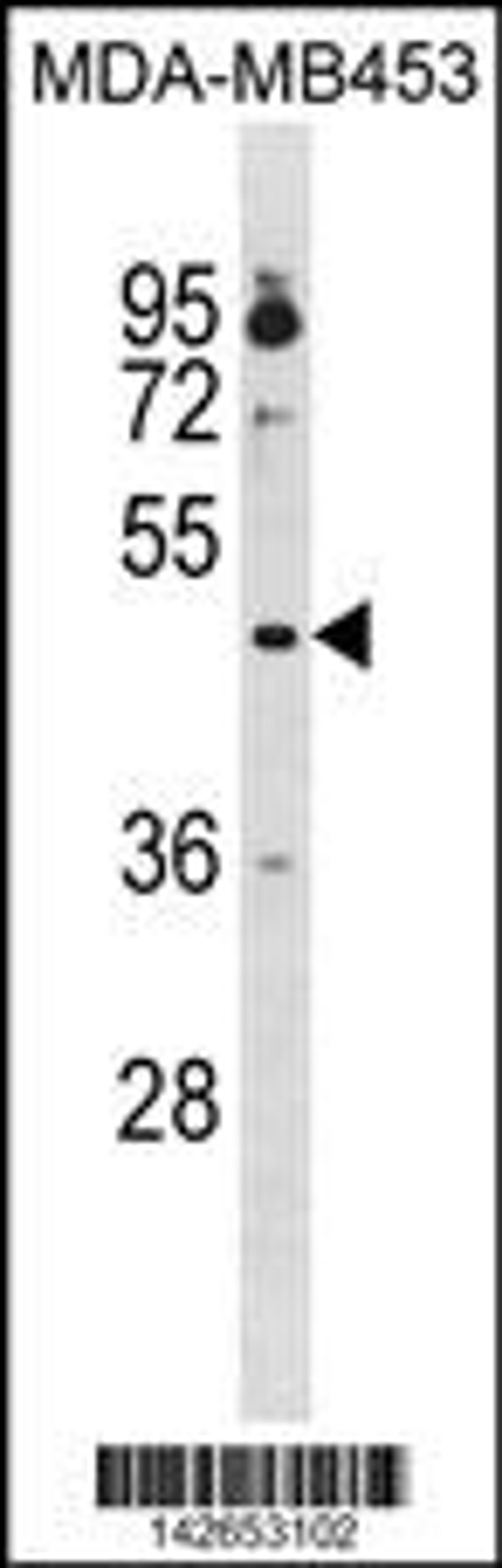 Western blot analysis in MDA-MB453 cell line lysates (35ug/lane).